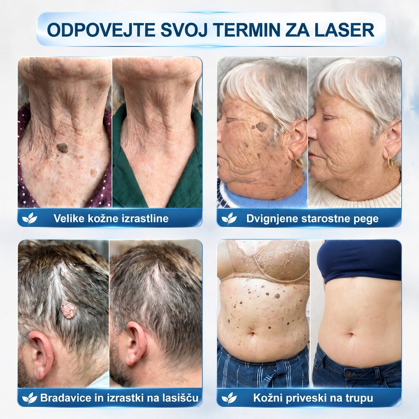 𝐏𝒊𝐜𝐝𝒐®👩‍⚕️🎁 7-𝑫𝒏𝒆𝒗𝒏𝒊 𝑶𝒅𝒔𝒕𝒓𝒂𝒏𝒋𝒆𝒗𝒂𝒏𝒋𝒆 𝑷𝒊𝒈𝒎𝒆𝒏𝒕𝒏𝒊𝒉 𝑴𝒂𝒅𝒆ž𝒆𝒗 𝑰𝒏 𝑩𝒓𝒂𝒛𝒈𝒐𝒕𝒊𝒏 𝑷𝒊𝒔𝒂𝒍𝒐(𝐵𝑟𝑒𝑧 𝑏𝑜𝑙𝑒č𝑖𝑛𝑒, 𝑏𝑟𝑒𝑧 𝑏𝑟𝑎𝑧𝑔𝑜𝑡𝑖𝑛 – 𝑟𝑜𝑙𝑙𝑒𝑟𝑏𝑎𝑙𝑙)