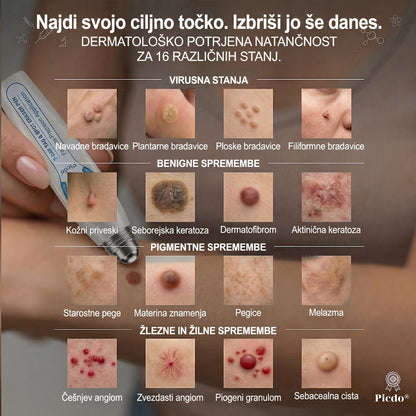 𝐏𝒊𝐜𝐝𝒐®👩‍⚕️🎁 7-𝑫𝒏𝒆𝒗𝒏𝒊 𝑶𝒅𝒔𝒕𝒓𝒂𝒏𝒋𝒆𝒗𝒂𝒏𝒋𝒆 𝑷𝒊𝒈𝒎𝒆𝒏𝒕𝒏𝒊𝒉 𝑴𝒂𝒅𝒆ž𝒆𝒗 𝑰𝒏 𝑩𝒓𝒂𝒛𝒈𝒐𝒕𝒊𝒏 𝑷𝒊𝒔𝒂𝒍𝒐(𝐵𝑟𝑒𝑧 𝑏𝑜𝑙𝑒č𝑖𝑛𝑒, 𝑏𝑟𝑒𝑧 𝑏𝑟𝑎𝑧𝑔𝑜𝑡𝑖𝑛 – 𝑟𝑜𝑙𝑙𝑒𝑟𝑏𝑎𝑙𝑙)