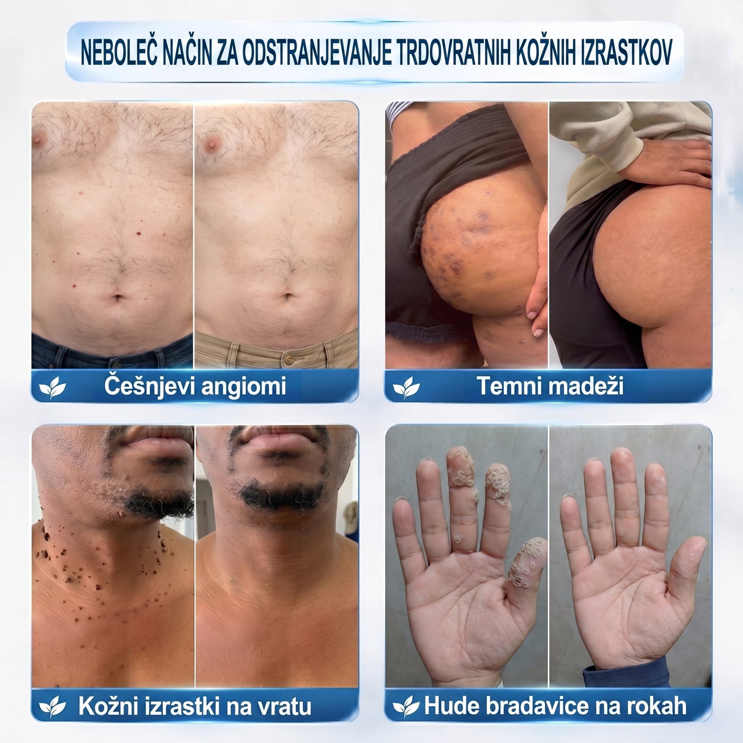 𝐏𝒊𝐜𝐝𝒐®👩‍⚕️🎁 7-𝑫𝒏𝒆𝒗𝒏𝒊 𝑶𝒅𝒔𝒕𝒓𝒂𝒏𝒋𝒆𝒗𝒂𝒏𝒋𝒆 𝑷𝒊𝒈𝒎𝒆𝒏𝒕𝒏𝒊𝒉 𝑴𝒂𝒅𝒆ž𝒆𝒗 𝑰𝒏 𝑩𝒓𝒂𝒛𝒈𝒐𝒕𝒊𝒏 𝑷𝒊𝒔𝒂𝒍𝒐(𝐵𝑟𝑒𝑧 𝑏𝑜𝑙𝑒č𝑖𝑛𝑒, 𝑏𝑟𝑒𝑧 𝑏𝑟𝑎𝑧𝑔𝑜𝑡𝑖𝑛 – 𝑟𝑜𝑙𝑙𝑒𝑟𝑏𝑎𝑙𝑙)