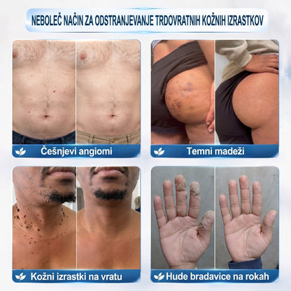 𝐏𝒊𝐜𝐝𝒐®👩‍⚕️🎁 7-𝑫𝒏𝒆𝒗𝒏𝒊 𝑶𝒅𝒔𝒕𝒓𝒂𝒏𝒋𝒆𝒗𝒂𝒏𝒋𝒆 𝑷𝒊𝒈𝒎𝒆𝒏𝒕𝒏𝒊𝒉 𝑴𝒂𝒅𝒆ž𝒆𝒗 𝑰𝒏 𝑩𝒓𝒂𝒛𝒈𝒐𝒕𝒊𝒏 𝑷𝒊𝒔𝒂𝒍𝒐(𝐵𝑟𝑒𝑧 𝑏𝑜𝑙𝑒č𝑖𝑛𝑒, 𝑏𝑟𝑒𝑧 𝑏𝑟𝑎𝑧𝑔𝑜𝑡𝑖𝑛 – 𝑟𝑜𝑙𝑙𝑒𝑟𝑏𝑎𝑙𝑙)
